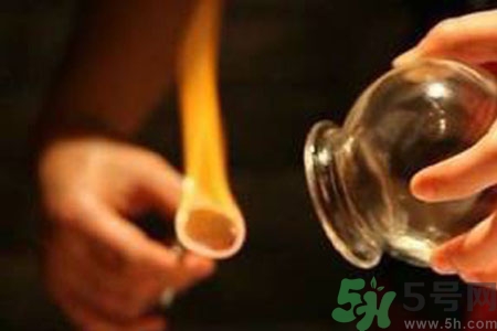老人能在家拔火罐嗎？老年人拔火罐需要注意什么？