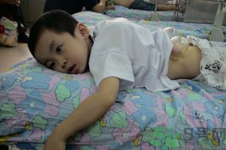 小孩可以拔罐嗎？寶寶能拔火罐嗎？