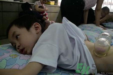 小孩可以拔罐嗎？寶寶能拔火罐嗎？