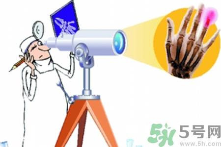 什么年齡測骨齡最好？如何測骨齡？