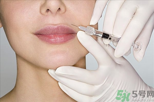 打膠原蛋白好還是玻尿酸好,玻尿酸和膠原蛋白的區(qū)別 打膠原蛋白好還是玻尿酸好,玻尿酸和膠原蛋白的區(qū)別