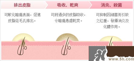 日本白兔牌暗瘡膏價格 白兔祛痘膏多少錢？