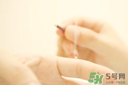 面癱能艾灸嗎？艾灸能治療面癱嗎？