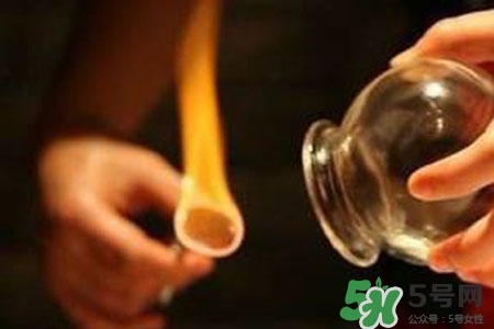 拔罐放血對身體好嗎？拔罐放血有什么好處？