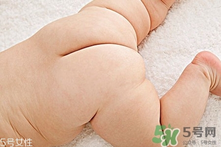 擴(kuò)肛有什么好處？擴(kuò)肛需要注意什么？