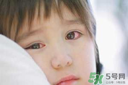孩子為什么老眨眼睛？孩子總眨眼睛怎么回事？