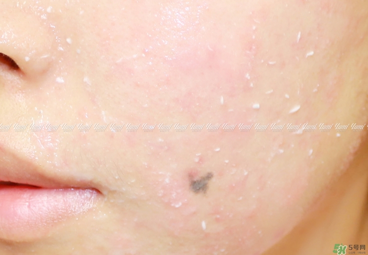 holika懶蛋蛋去角質(zhì)多少錢？holika雞蛋去角質(zhì)啫喱價(jià)格