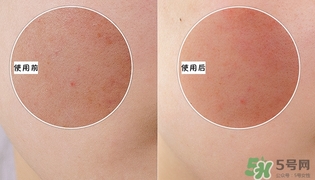 holika懶蛋蛋去角質(zhì)多少錢？holika雞蛋去角質(zhì)啫喱價(jià)格