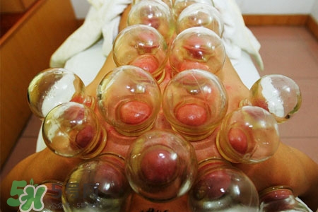 拔罐后皮膚發(fā)癢是怎么回事？拔罐后為什么皮膚會(huì)癢？