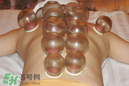拔火罐后皮膚癢正常嗎？拔火罐后皮膚癢什么原因？
