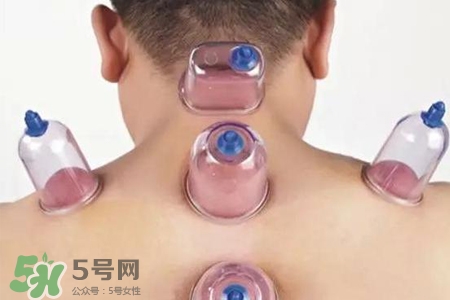 拔罐后可以喝酒嗎？拔罐后多久能喝酒？