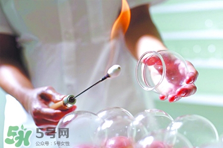 拔罐后可以貼膏藥嗎？拔罐后多久能貼膏藥？
