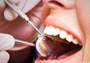 拔牙之后可以吃藥嗎？拔牙之后要不要吃藥？