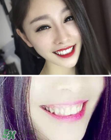 碧緹福冷光牙齒美白儀怎么用？碧緹福冷光牙齒美白儀使用方法