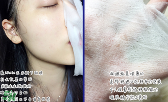 稚優(yōu)泉面膜怎么用？稚優(yōu)泉面膜要洗嗎？