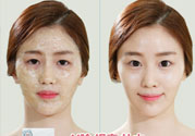 skin1004是什么牌子？skin1004屬于什么檔次