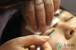 埋線雙眼皮需要拆線嗎？埋線雙眼皮怎么拆線