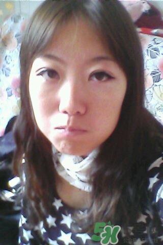 什么是定點(diǎn)雙眼皮？定點(diǎn)雙眼皮多少錢？