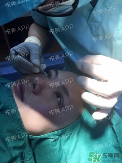 定點雙眼皮恢復(fù)過程圖_定點雙眼皮要多久恢復(fù) 定點雙眼皮恢復(fù)過程圖_定點雙眼皮要多久恢復(fù)