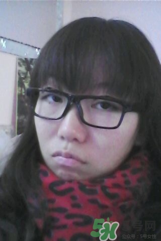 什么是定點(diǎn)雙眼皮？定點(diǎn)雙眼皮多少錢？