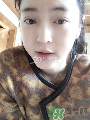 什么是定點(diǎn)雙眼皮？定點(diǎn)雙眼皮多少錢？
