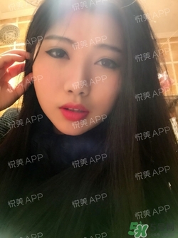 切開雙眼皮消腫過(guò)程圖_切開雙眼皮恢復(fù)過(guò)程圖