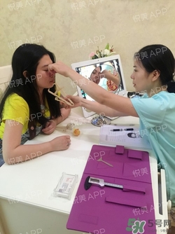 切開雙眼皮消腫過(guò)程圖_切開雙眼皮恢復(fù)過(guò)程圖