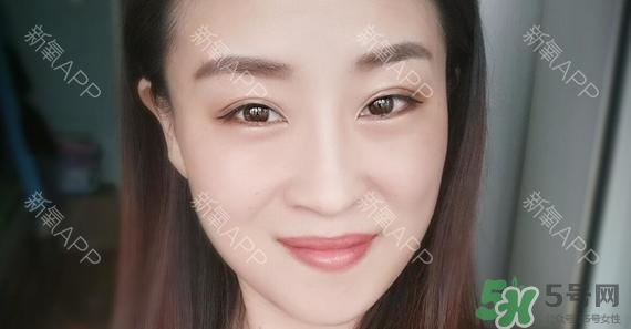 埋線雙眼皮能保持多久？埋線雙眼皮是永久嗎
