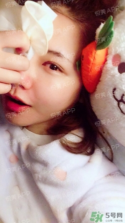 定點雙眼皮恢復(fù)過程圖_定點雙眼皮要多久恢復(fù) 定點雙眼皮恢復(fù)過程圖_定點雙眼皮要多久恢復(fù)