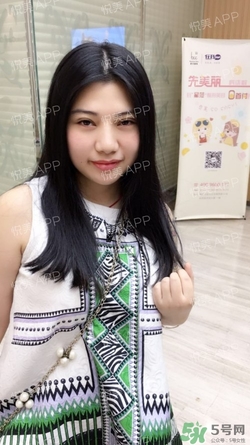 切開雙眼皮消腫過(guò)程圖_切開雙眼皮恢復(fù)過(guò)程圖