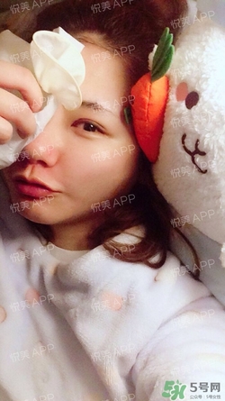 定點雙眼皮恢復(fù)過程圖_定點雙眼皮要多久恢復(fù) 定點雙眼皮恢復(fù)過程圖_定點雙眼皮要多久恢復(fù)