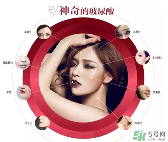 喬雅登是哪個(gè)國(guó)家的？喬雅登玻尿酸哪個(gè)國(guó)家？