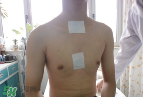 三九貼怎么貼？三九貼的貼法