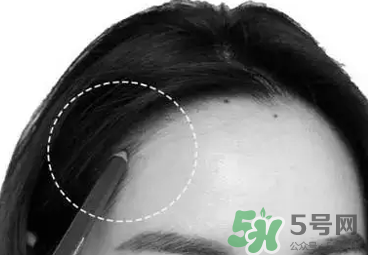 發(fā)際線高適合什么發(fā)型？發(fā)際線高怎么辦