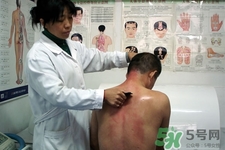 刮痧可以去濕氣嗎？體內濕氣重刮痧有用嗎？