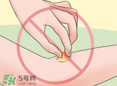 水泡怎么處理？水泡要不要刺破？