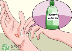 水泡怎么處理？水泡要不要刺破？