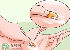 水泡怎么處理？水泡要不要刺破？