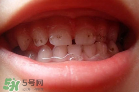 刷牙后吃東西發(fā)苦正常嗎？為什么刷牙后吃東西發(fā)苦？