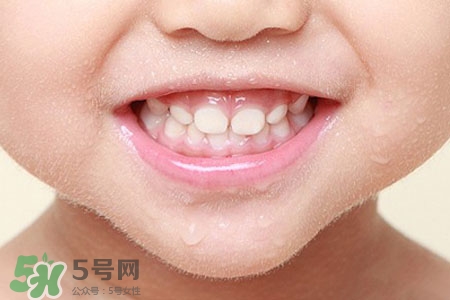 刷牙后吃東西發(fā)苦正常嗎？為什么刷牙后吃東西發(fā)苦？
