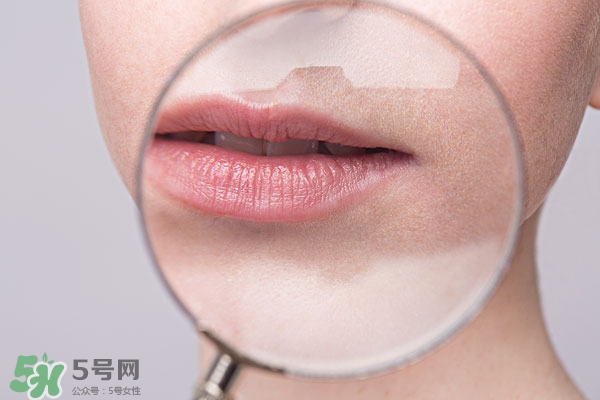 嘴唇起泡腫了怎么辦？嘴唇起泡腫了怎么消腫