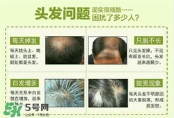 牛角梳梳頭可以生發(fā)嗎？牛角梳怎么梳頭？
