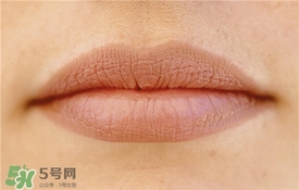 卡唇紋是什么意思？卡唇紋怎么辦？