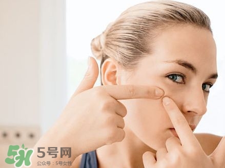 便秘對(duì)皮膚有什么影響？便秘對(duì)身體有什么危害？