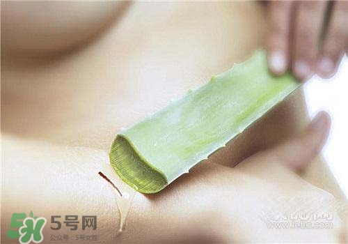 蘆薈涂在臉上發(fā)癢是怎么回事？蘆薈涂在臉上發(fā)癢怎么辦？