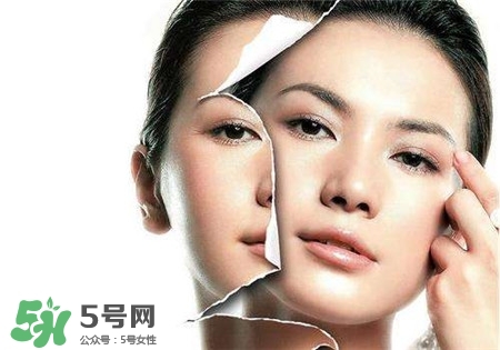 美白針是什么？美白針可以連續(xù)打嗎？
