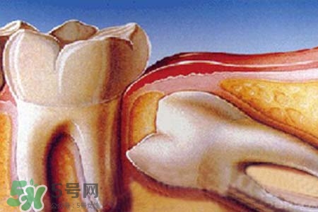 智齒會一直長嗎？智齒會停止生長嗎？