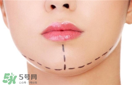 玻尿酸墊下巴能維持多久？玻尿酸墊下巴能維持多長時間？