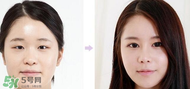 哪些人需要開眼角？需要開眼角的眼睛圖片