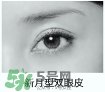 歐式雙眼皮適合什么人 歐式雙眼皮前后對(duì)比 歐式雙眼皮適合什么人 歐式雙眼皮前后對(duì)比